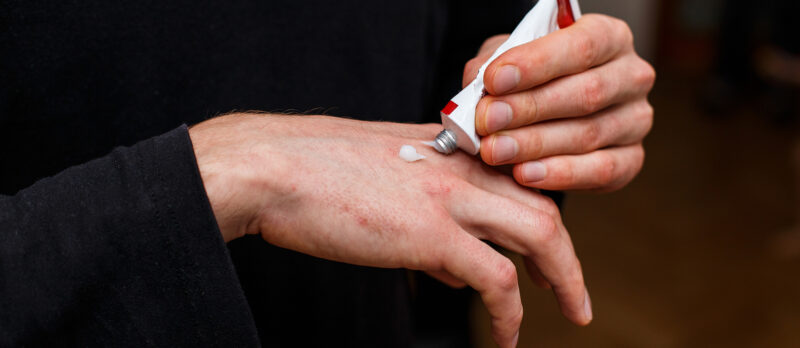 Dealing with Eczema in Changing Weather